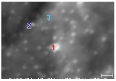 Figure 1 SEM