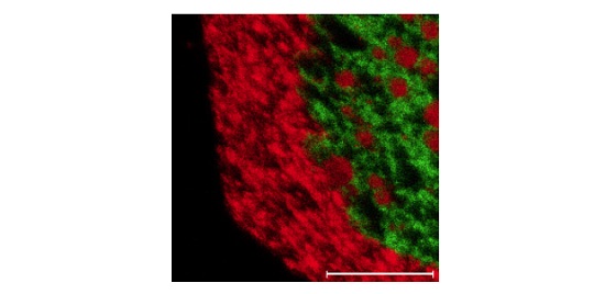 Figure 5 TOF chemical map showing organic molecule (green) and Mg (red) distribution on a surface.