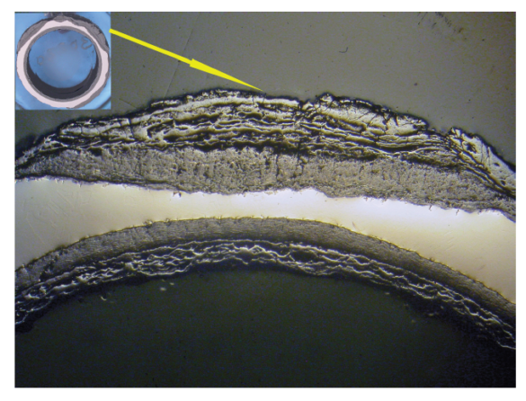 Distorted Ss Pipe Failure analysis metals, nonmetals, composites | EAG Laboratories